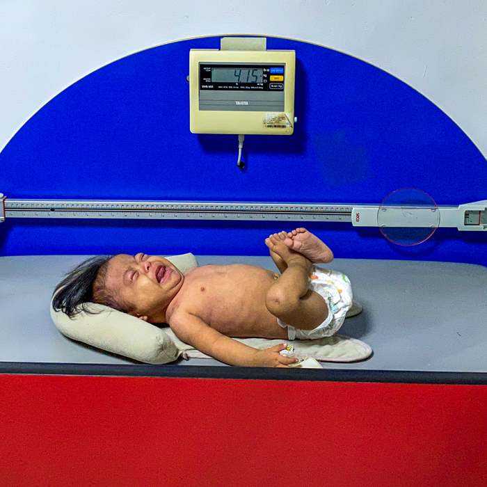 Little Melani weighed just over 9-pounds