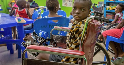 Pemphero under treatment at the CURE hospital in Malawi
