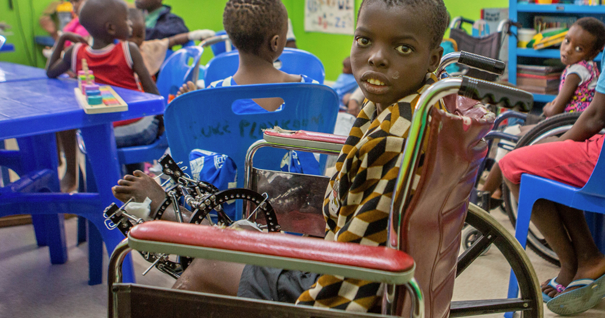 Pemphero under treatment at the CURE hospital in Malawi