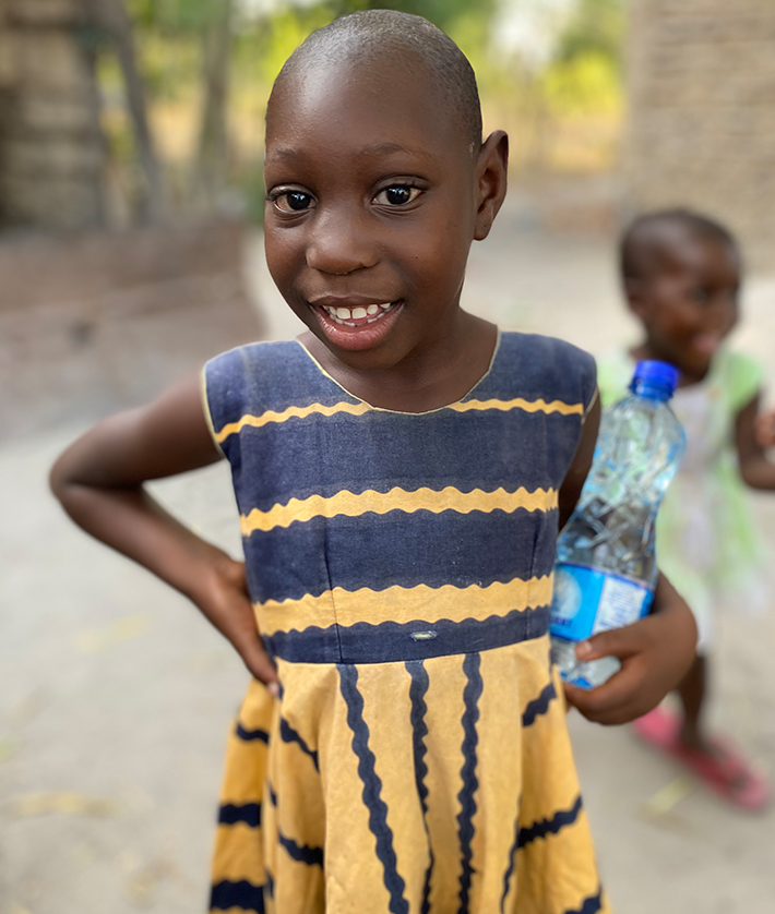 Young girl with Microcephaly