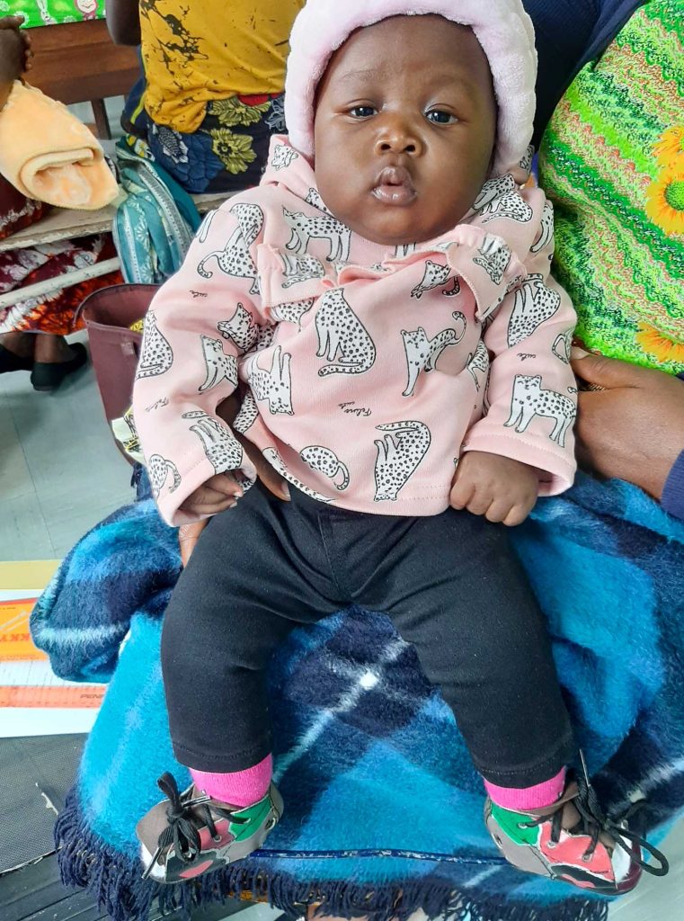 Zambian baby girl Hanna on her mother's lap, wearing corrective equipment for her feet