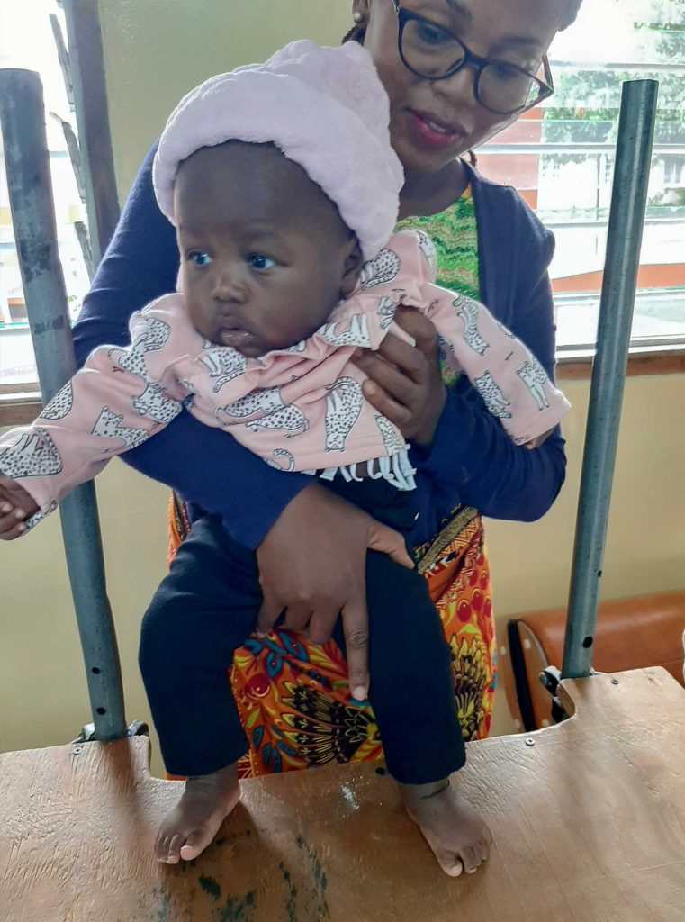 Zambian baby girl Hanna standing on a table, held by her mother, after receiving treatment for her feet